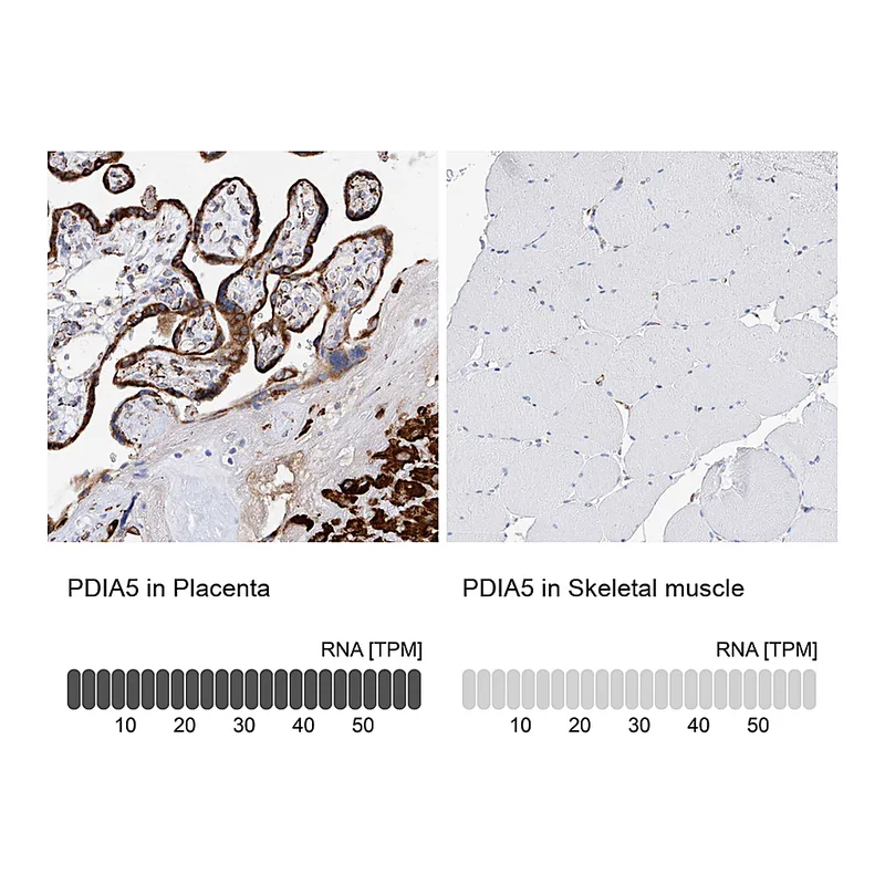 Atlas Antibodies Anti-PDIA5 Antibody
