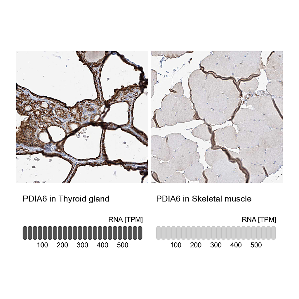 Atlas Antibodies Anti-PDIA6 Antibody