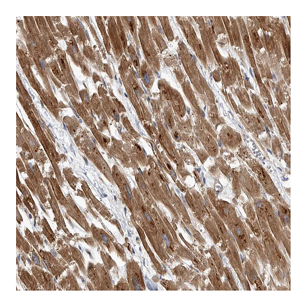 Atlas Antibodies Anti-PDK1 Antibody