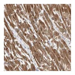 Atlas Antibodies Anti-PDK1 Antibody