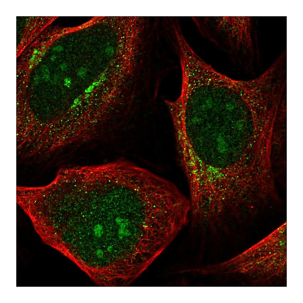 Atlas Antibodies Anti-PDK1 Antibody