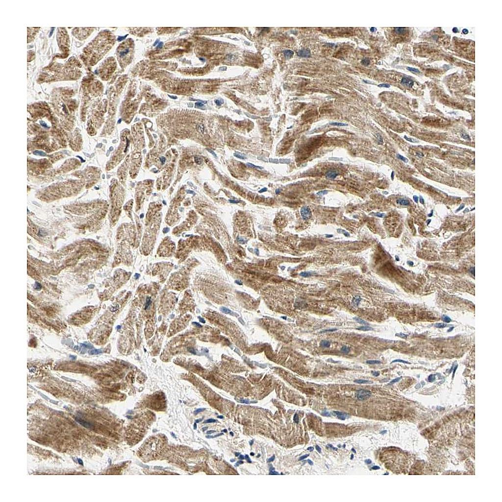 Atlas Antibodies Anti-PDK2 Antibody
