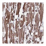 Atlas Antibodies Anti-PDK4 Antibody