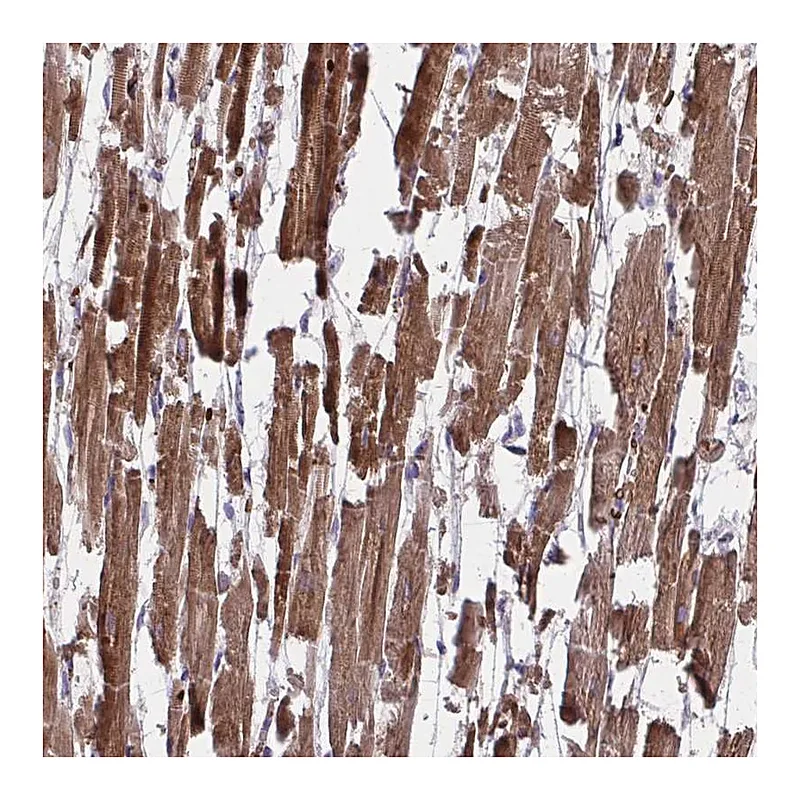 Atlas Antibodies Anti-PDK4 Antibody