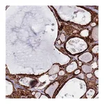 Atlas Antibodies Anti-PDK3 Antibody