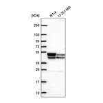 Atlas Antibodies Anti-PDK3 Antibody