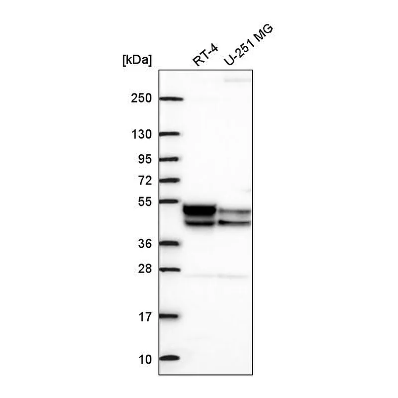 Atlas Antibodies Anti-PDK3 Antibody