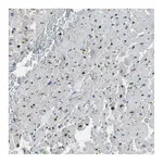 Atlas Antibodies Anti-PDLIM1 Antibody