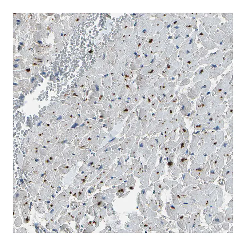 Atlas Antibodies Anti-PDLIM1 Antibody