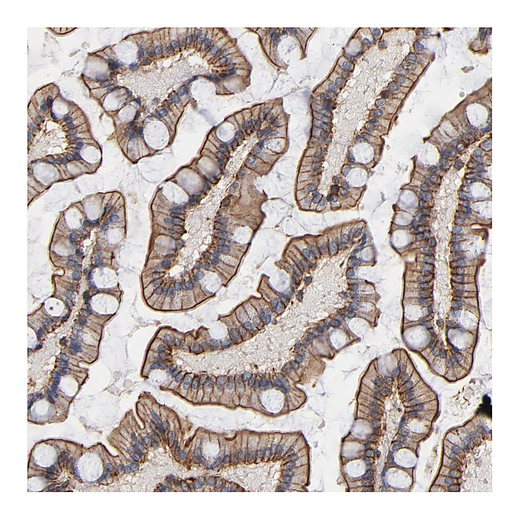 Atlas Antibodies Anti-PDLIM2 Antibody