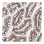 Atlas Antibodies Anti-PDLIM2 Antibody
