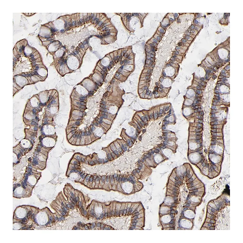 Atlas Antibodies Anti-PDLIM2 Antibody