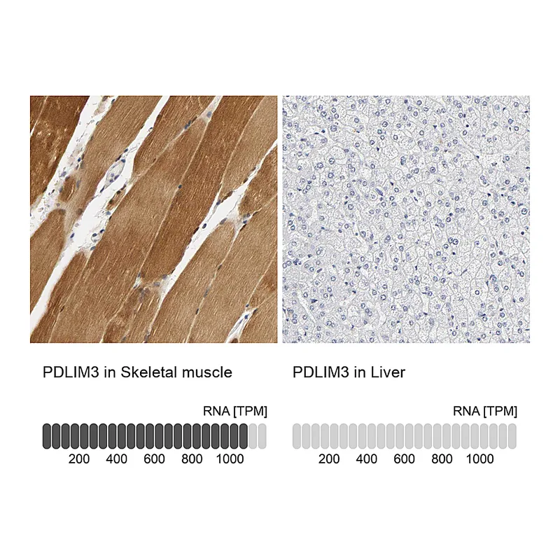 Atlas Antibodies Anti-PDLIM3 Antibody