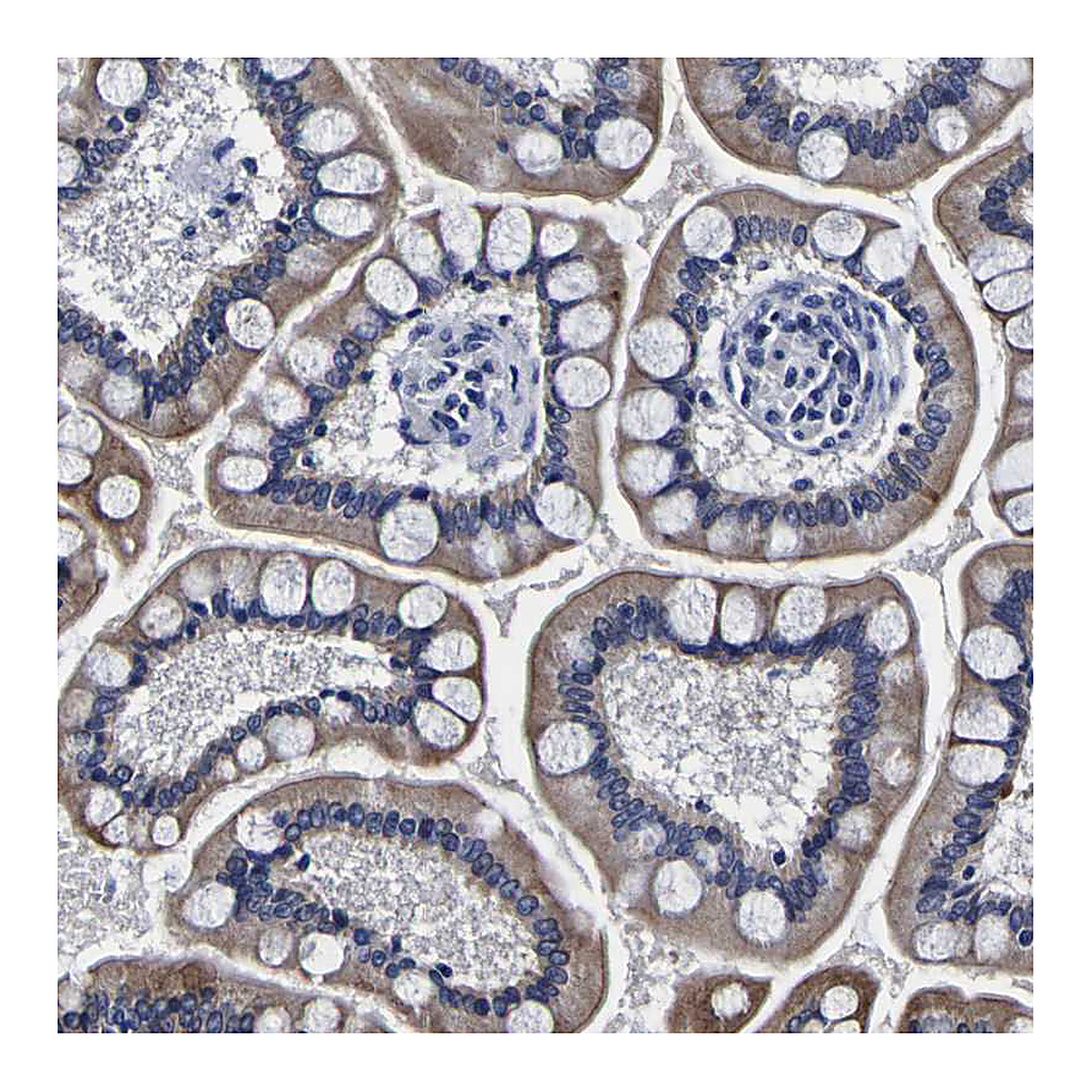 Atlas Antibodies Anti-PDLIM4 Antibody