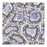 Atlas Antibodies Anti-PDLIM4 Antibody