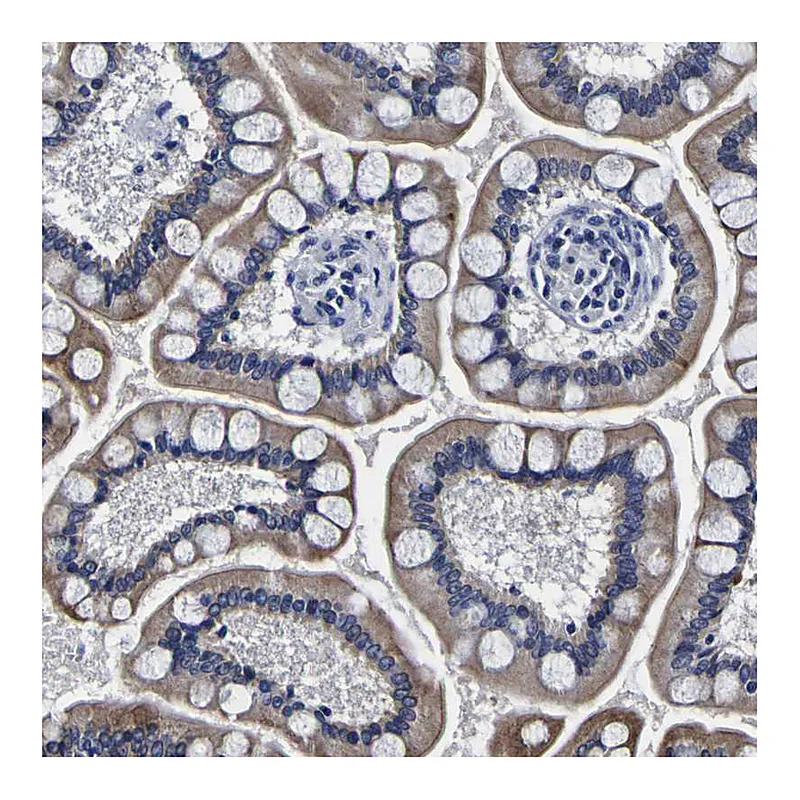 Atlas Antibodies Anti-PDLIM4 Antibody