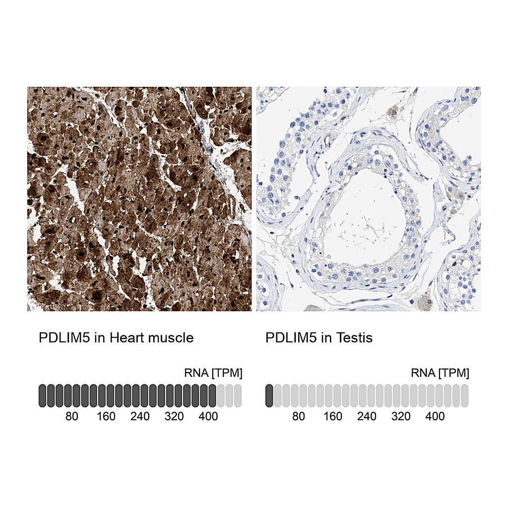 Atlas Antibodies Anti-PDLIM5 Antibody