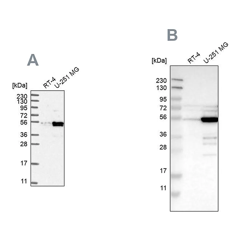 Atlas Antibodies Anti-PDLIM7 Antibody