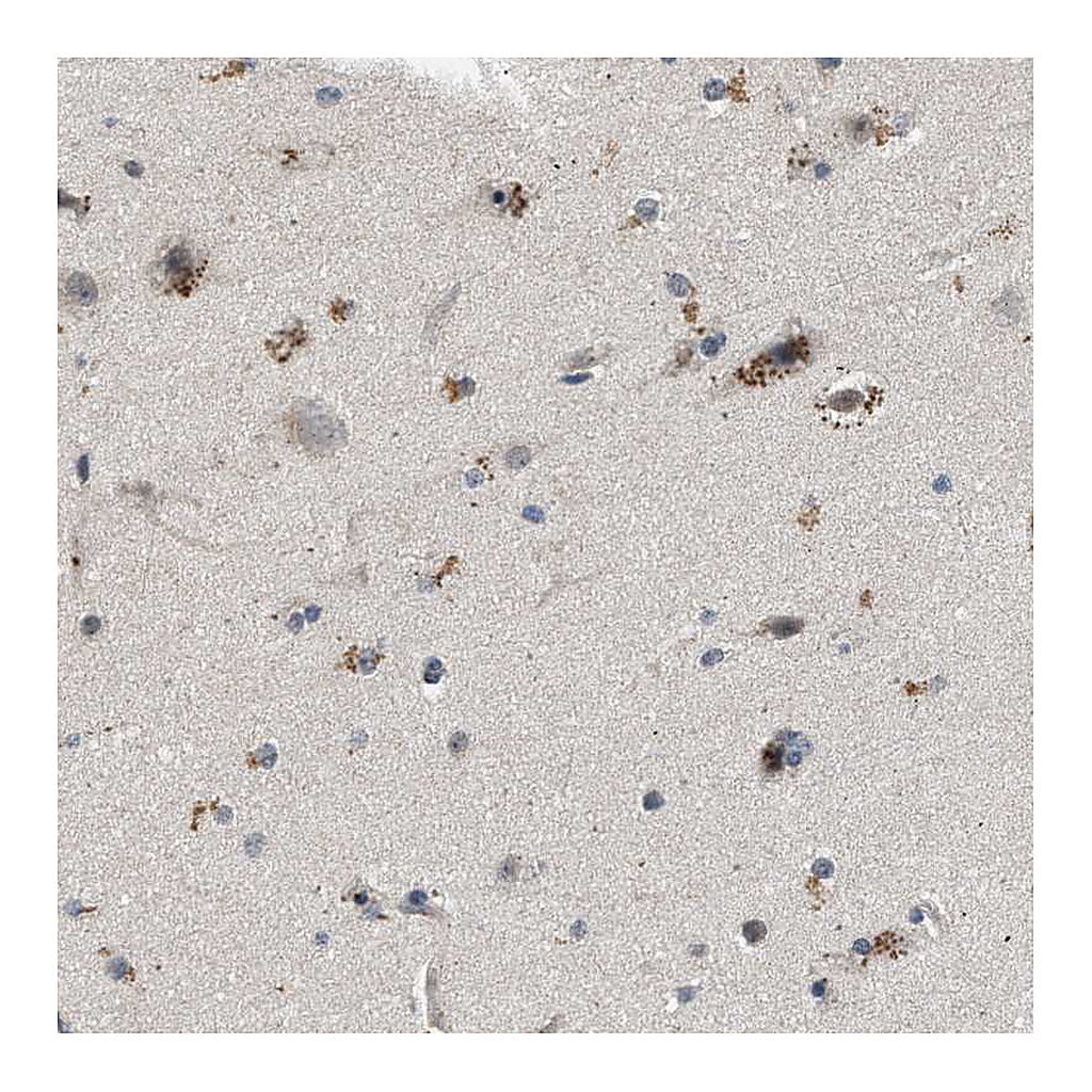 Atlas Antibodies Anti-PDP1 Antibody