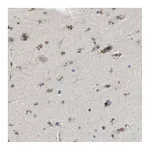 Atlas Antibodies Anti-PDP1 Antibody
