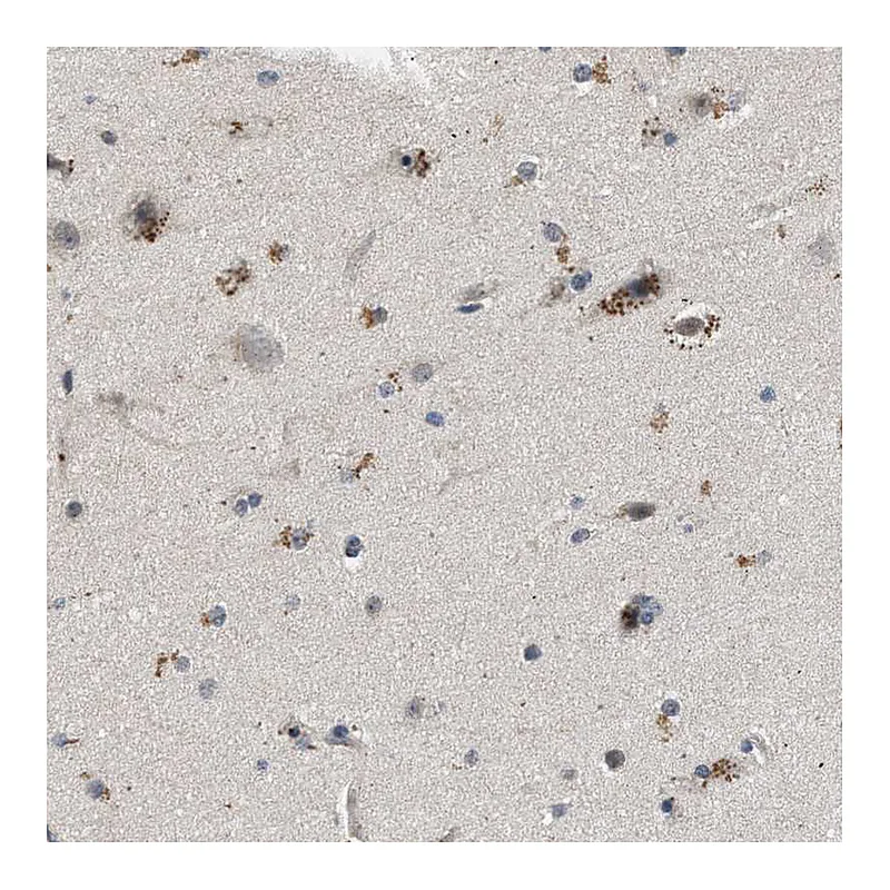 Atlas Antibodies Anti-PDP1 Antibody