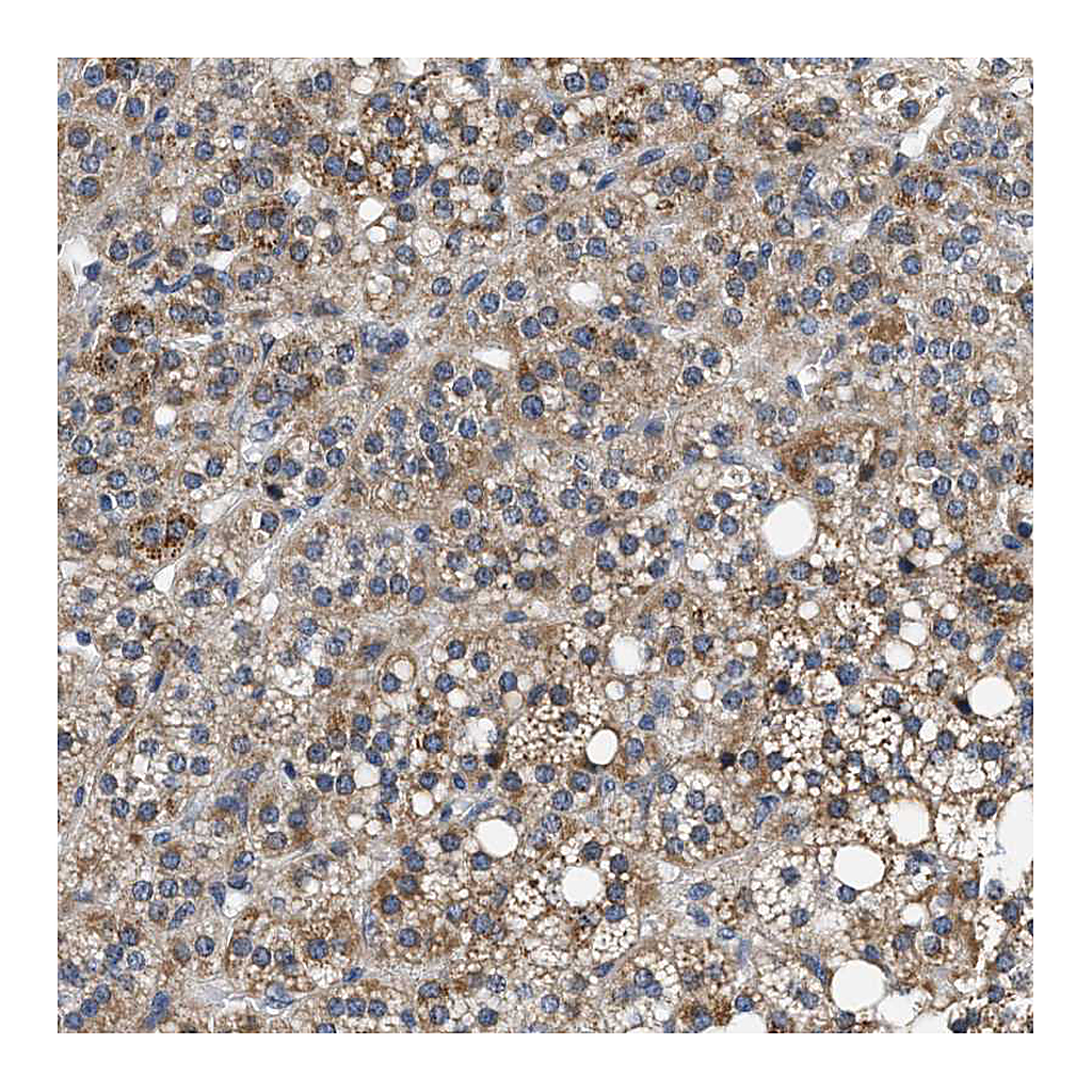 Atlas Antibodies Anti-PDP1 Antibody