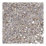 Atlas Antibodies Anti-PDP1 Antibody