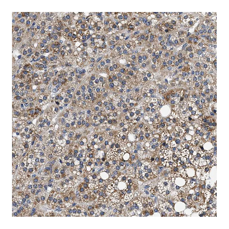 Atlas Antibodies Anti-PDP1 Antibody
