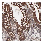 Atlas Antibodies Anti-PDLIM5 Antibody