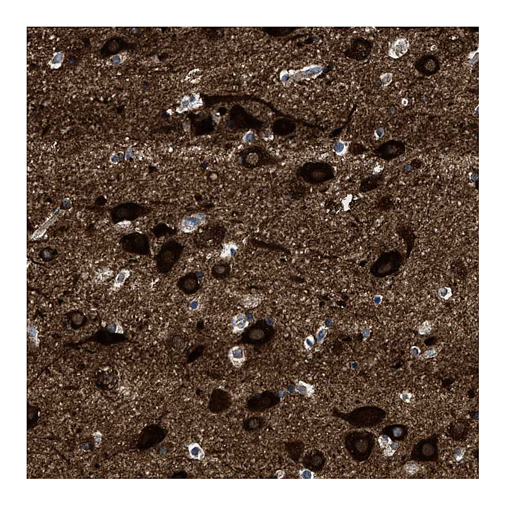 Atlas Antibodies Anti-PDP1 Antibody