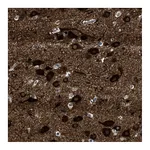 Atlas Antibodies Anti-PDP1 Antibody