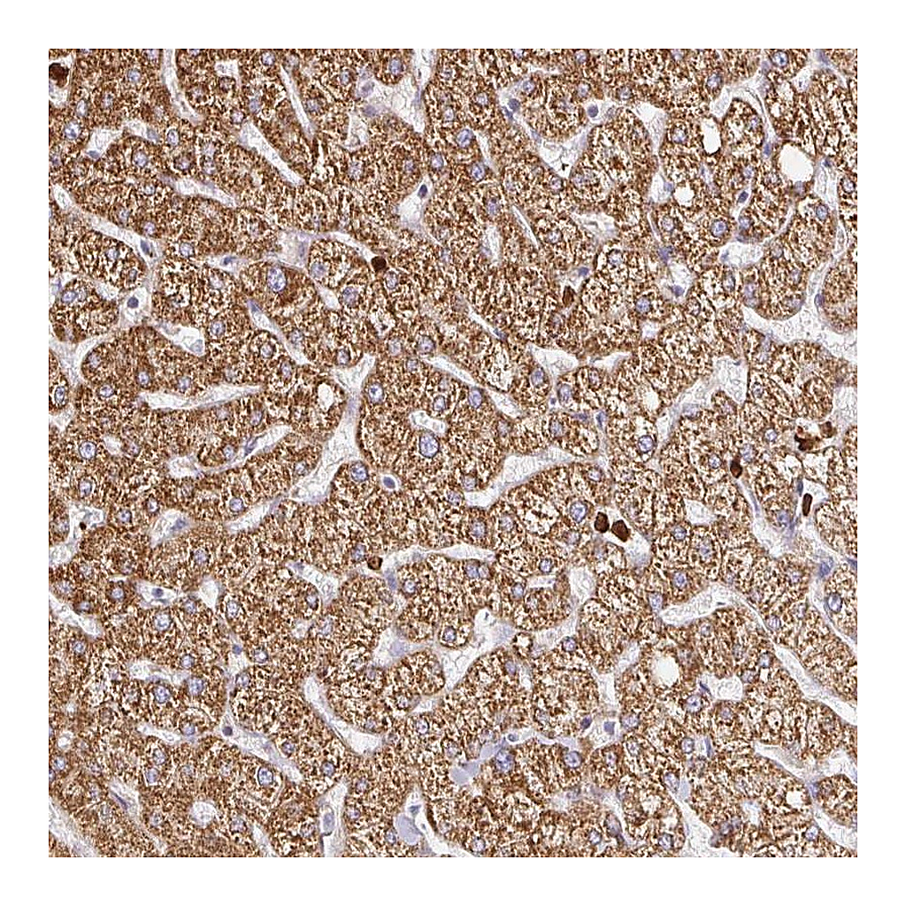 Atlas Antibodies Anti-PDPK1 Antibody