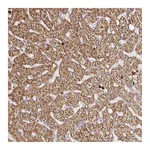Atlas Antibodies Anti-PDPK1 Antibody