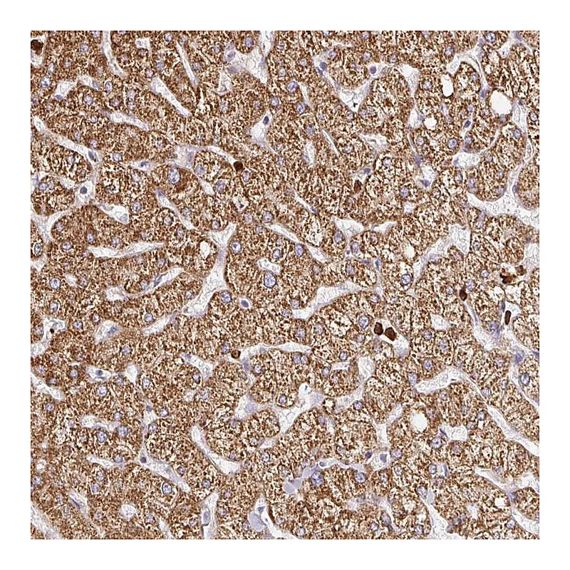 Atlas Antibodies Anti-PDPK1 Antibody