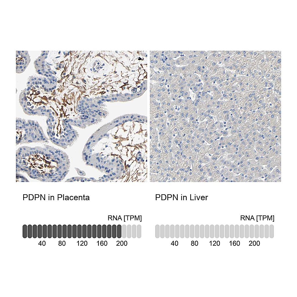 Atlas Antibodies Anti-PDPN Antibody