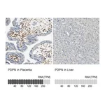 Atlas Antibodies Anti-PDPN Antibody