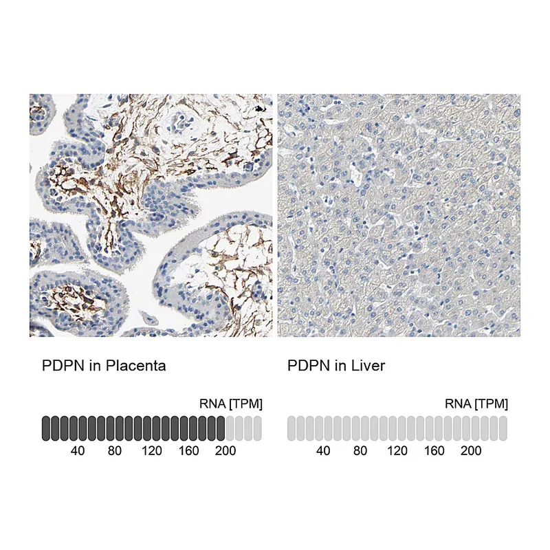 Atlas Antibodies Anti-PDPN Antibody