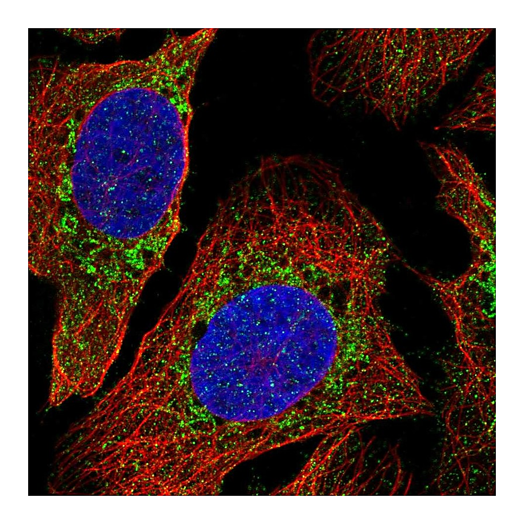 Atlas Antibodies Anti-PDPR Antibody