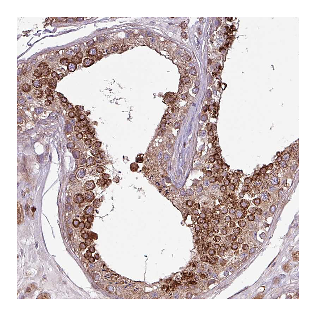 Atlas Antibodies Anti-PDPR Antibody