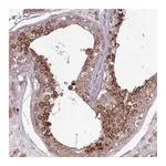 Atlas Antibodies Anti-PDPR Antibody