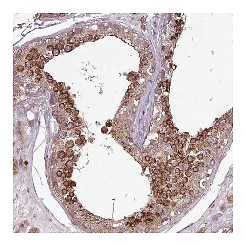 Atlas Antibodies Anti-PDPR Antibody
