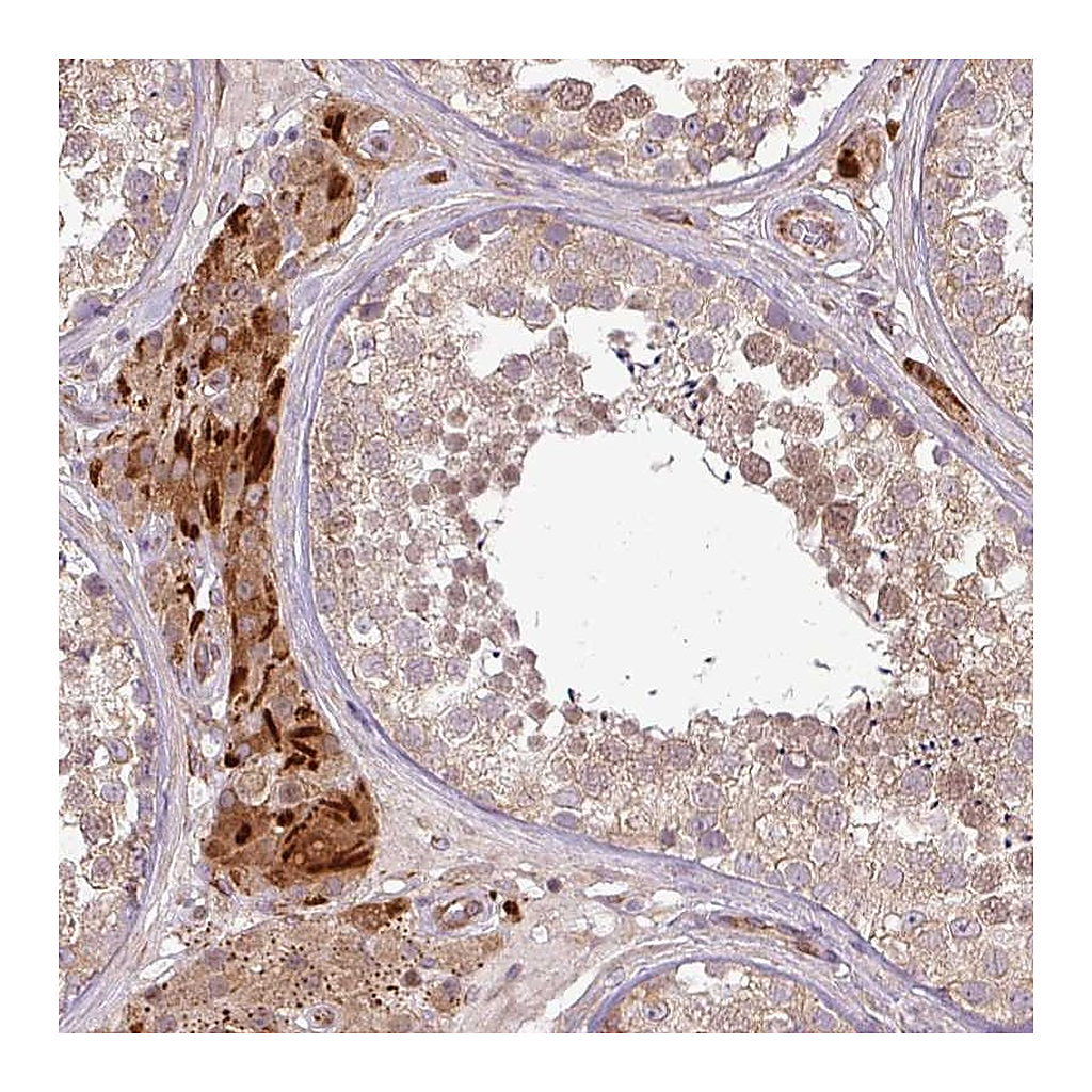 Atlas Antibodies Anti-PDRG1 Antibody