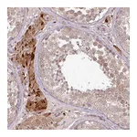 Atlas Antibodies Anti-PDRG1 Antibody