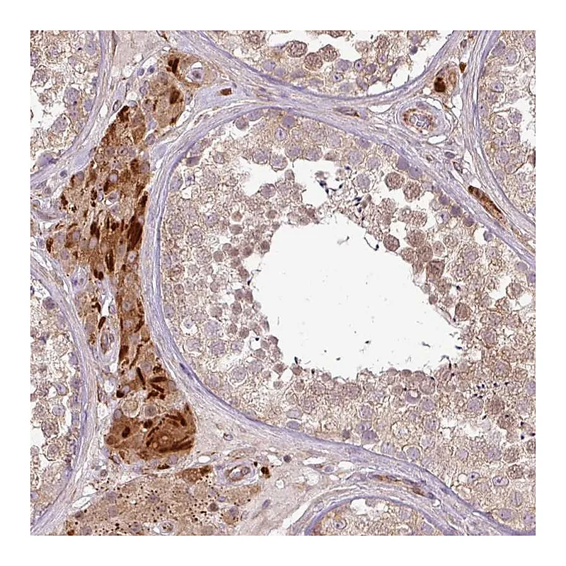 Atlas Antibodies Anti-PDRG1 Antibody