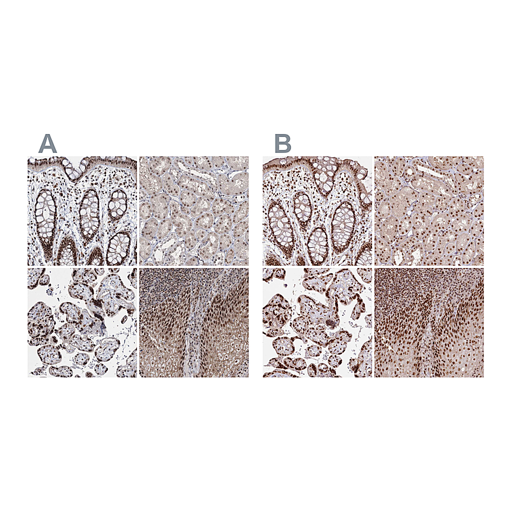 Atlas Antibodies Anti-PDS5A Antibody