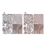 Atlas Antibodies Anti-PDS5A Antibody