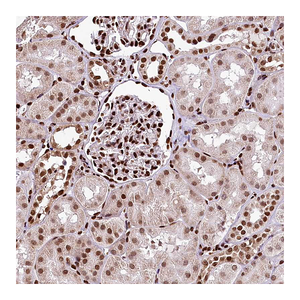 Atlas Antibodies Anti-PDS5B Antibody