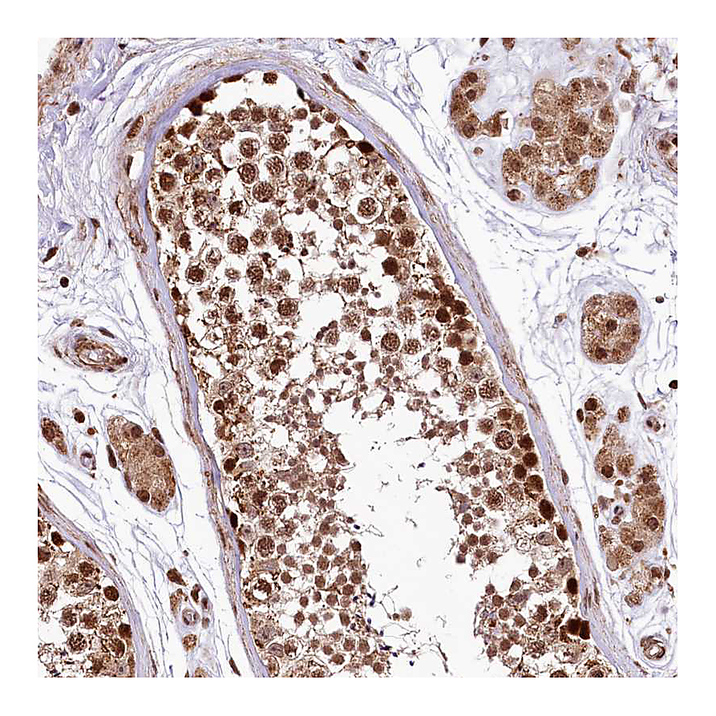 Atlas Antibodies Anti-PDS5B Antibody