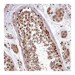 Atlas Antibodies Anti-PDS5B Antibody