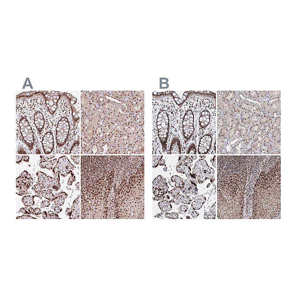 Atlas Antibodies Anti-PDS5A Antibody